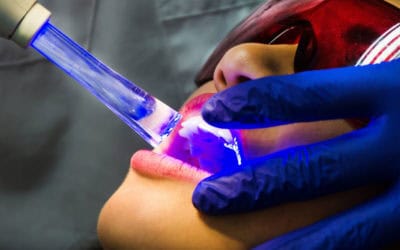 How Laser Dentistry Can Help Your Smile