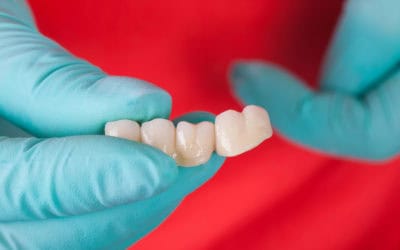 A Dental Bridge Can Help with Missing Teeth