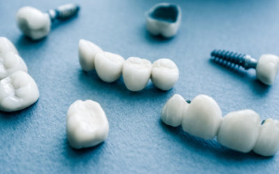 The Fundamentals of Tooth Replacement