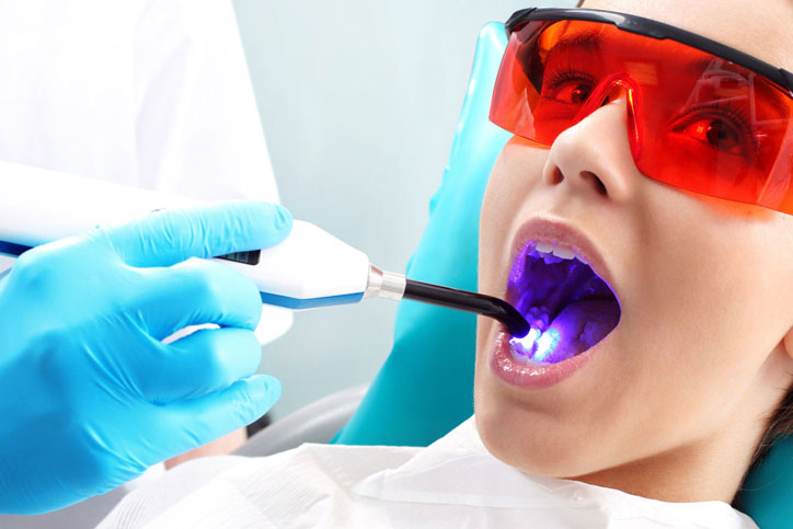 laser-dentistry2-724