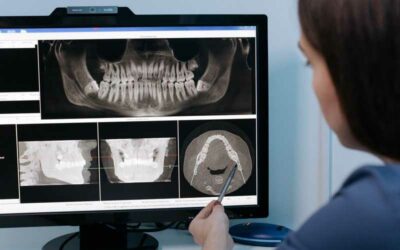 How 3D Digital Dental Impressions are Elevating Dental Care