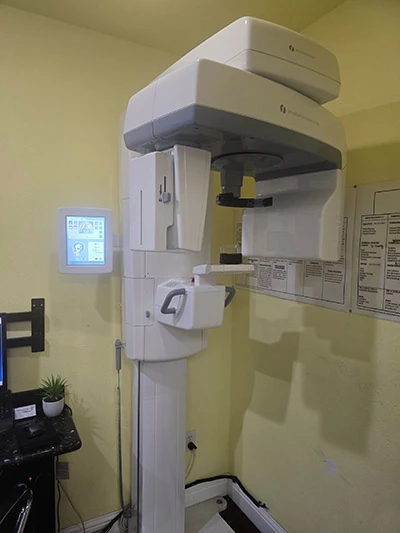 CBCT scanner at Gateway Oaks Dental in Sacramento, CA