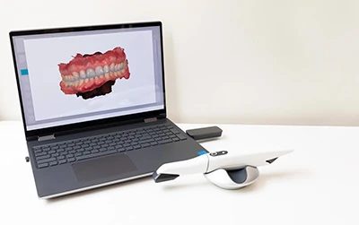 intraoral camera used at Gateway Oaks Dental