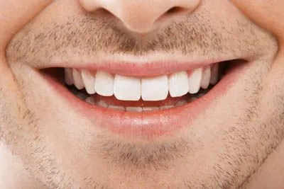 teeth whitening results from Gateway Oaks Dental